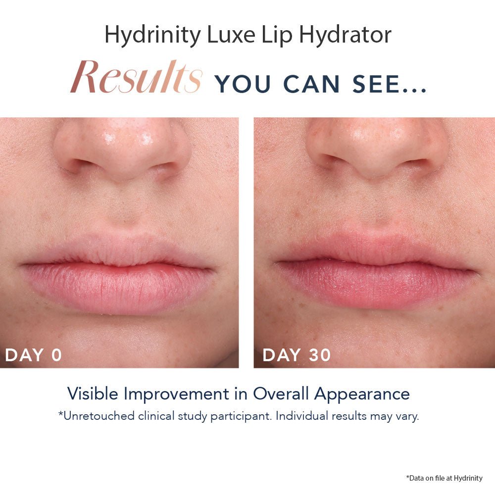 HYDRINITY Luxe Lip Hydrator - Your Skincare Source