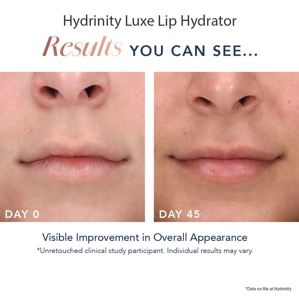 HYDRINITY Luxe Lip Hydrator - Your Skincare Source