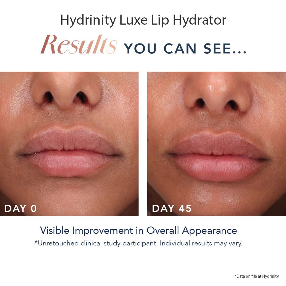 HYDRINITY Luxe Lip Hydrator - Your Skincare Source