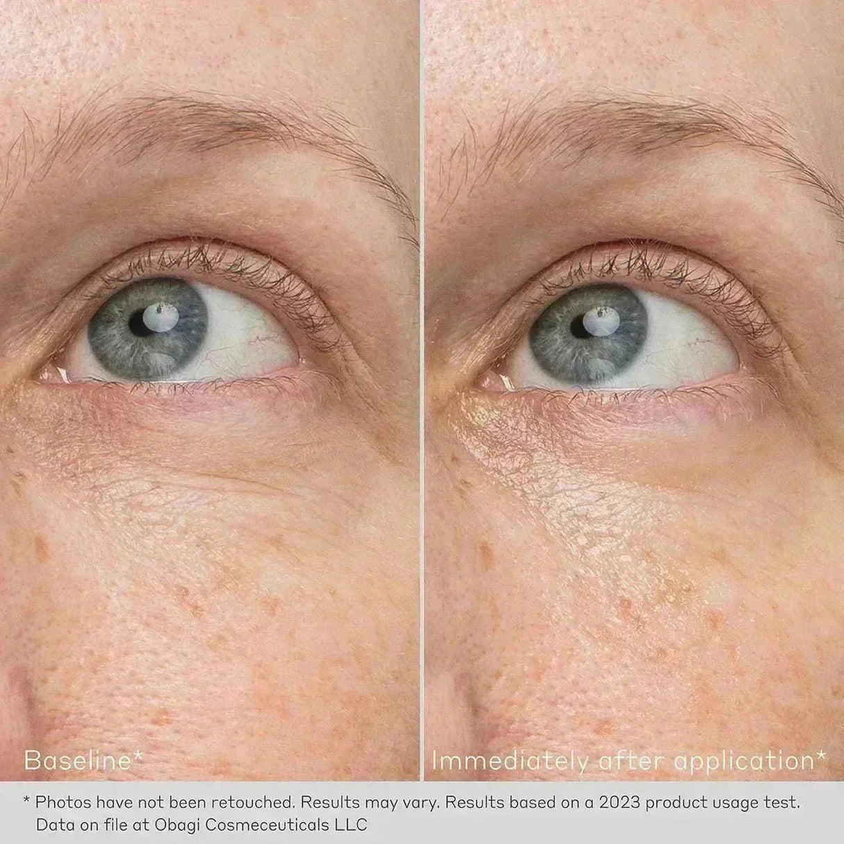 OBAGI Daily Hydro - Drops Rejuvenating Eye Gel Cream | Brightening & Smoothing Eye Gel Cream - Your Skincare Source