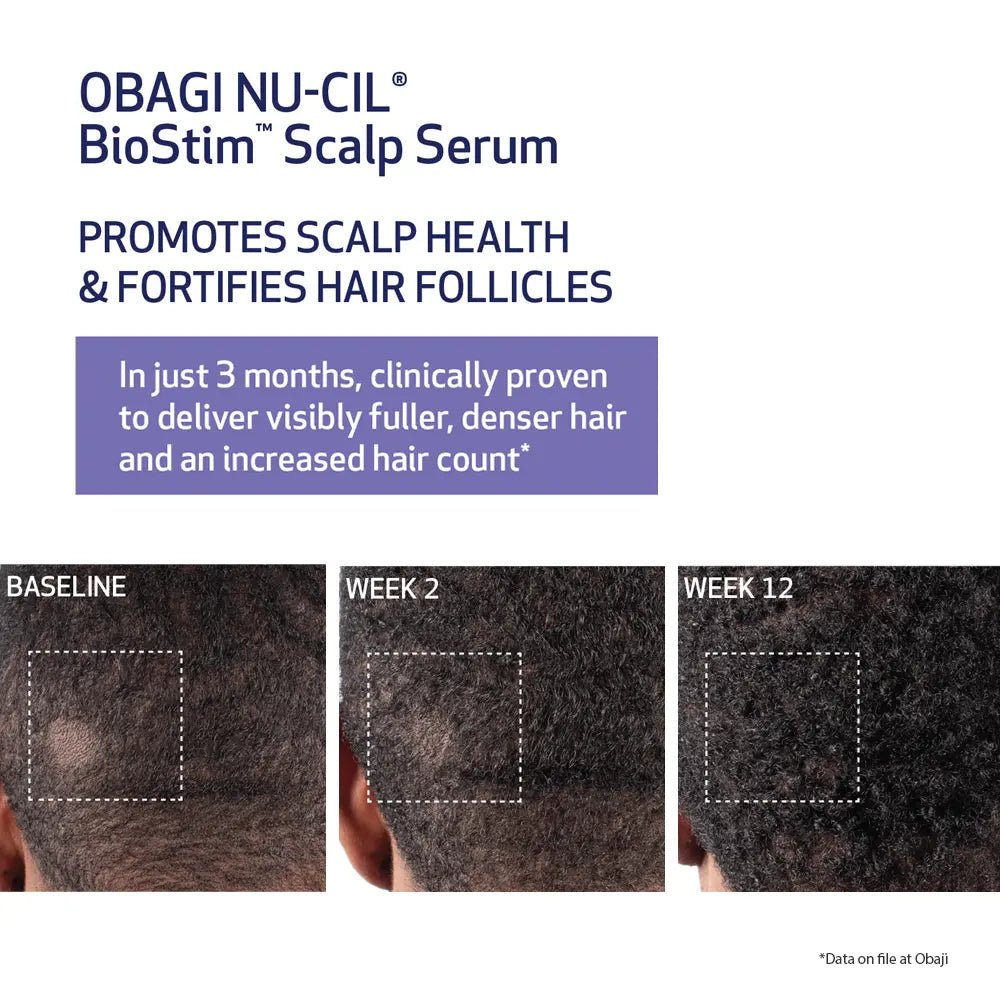 OBAGI NU-CIL BioStim Scalp Serum showing scalp health improvement over time.
