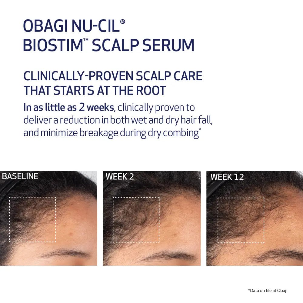 Obagi Nu-Cil Biostim Scalp Serum showing before and after results on female hair.