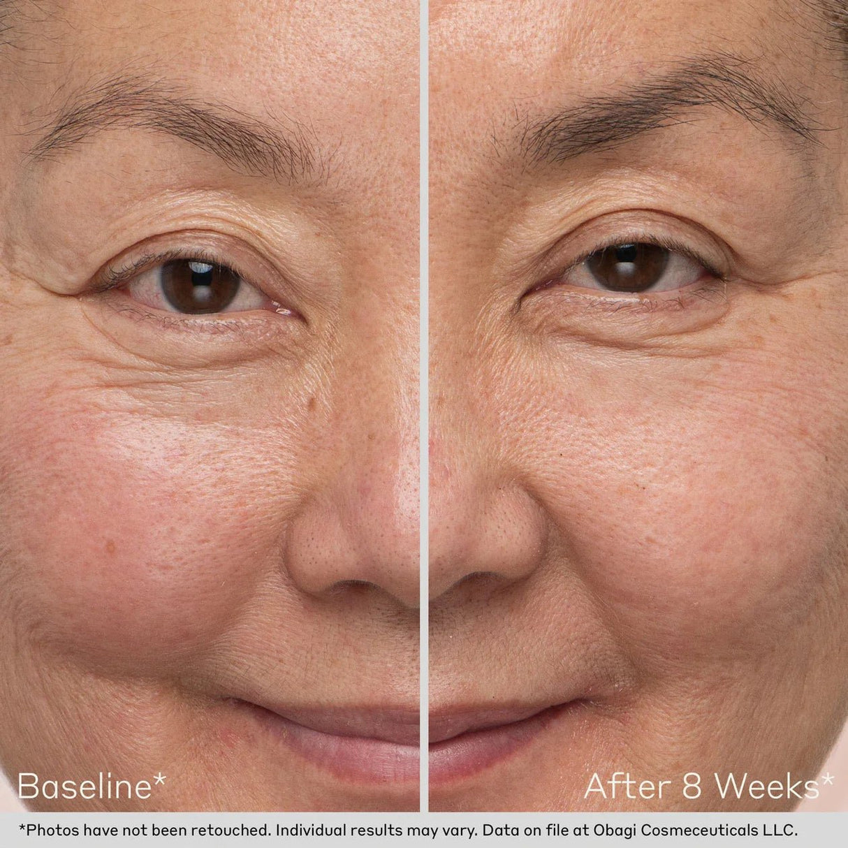 OBAGI Nu - Cil™ Eyebrow Boosting Serum | Nourishing Eyebrow Serum - Your Skincare Source