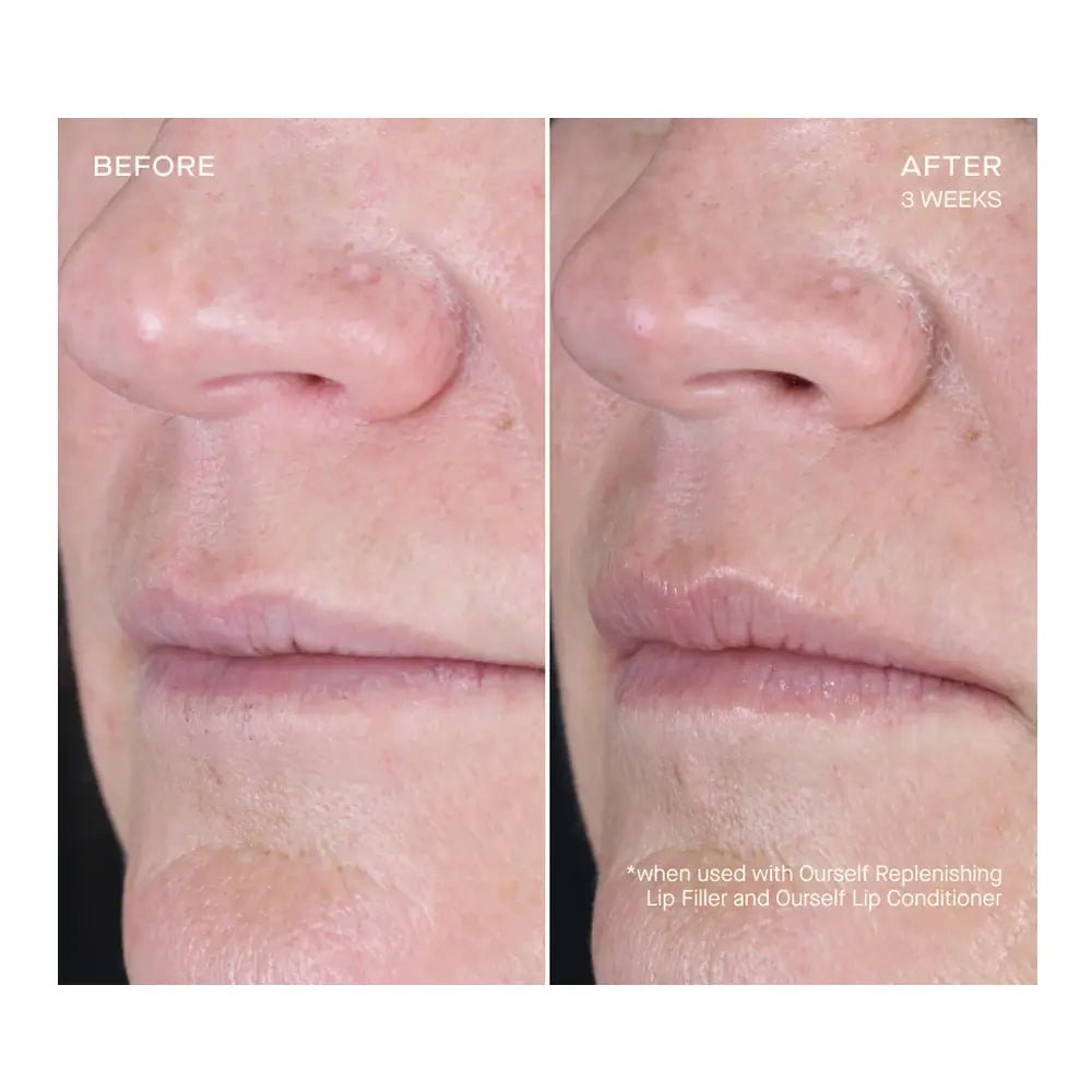 OURSELF Replenishing Lip Filler With Refill - NextGen
