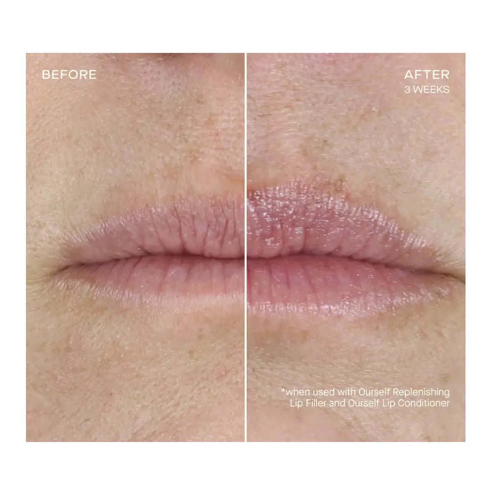 OURSELF Replenishing Lip Filler With Refill - NextGen