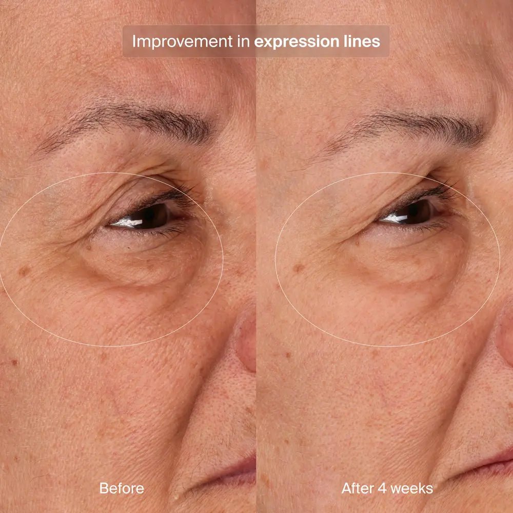 Pavise Bioadaptive Stress Repair