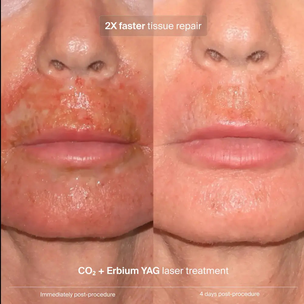 Pavise Extracellular Matrix Restore