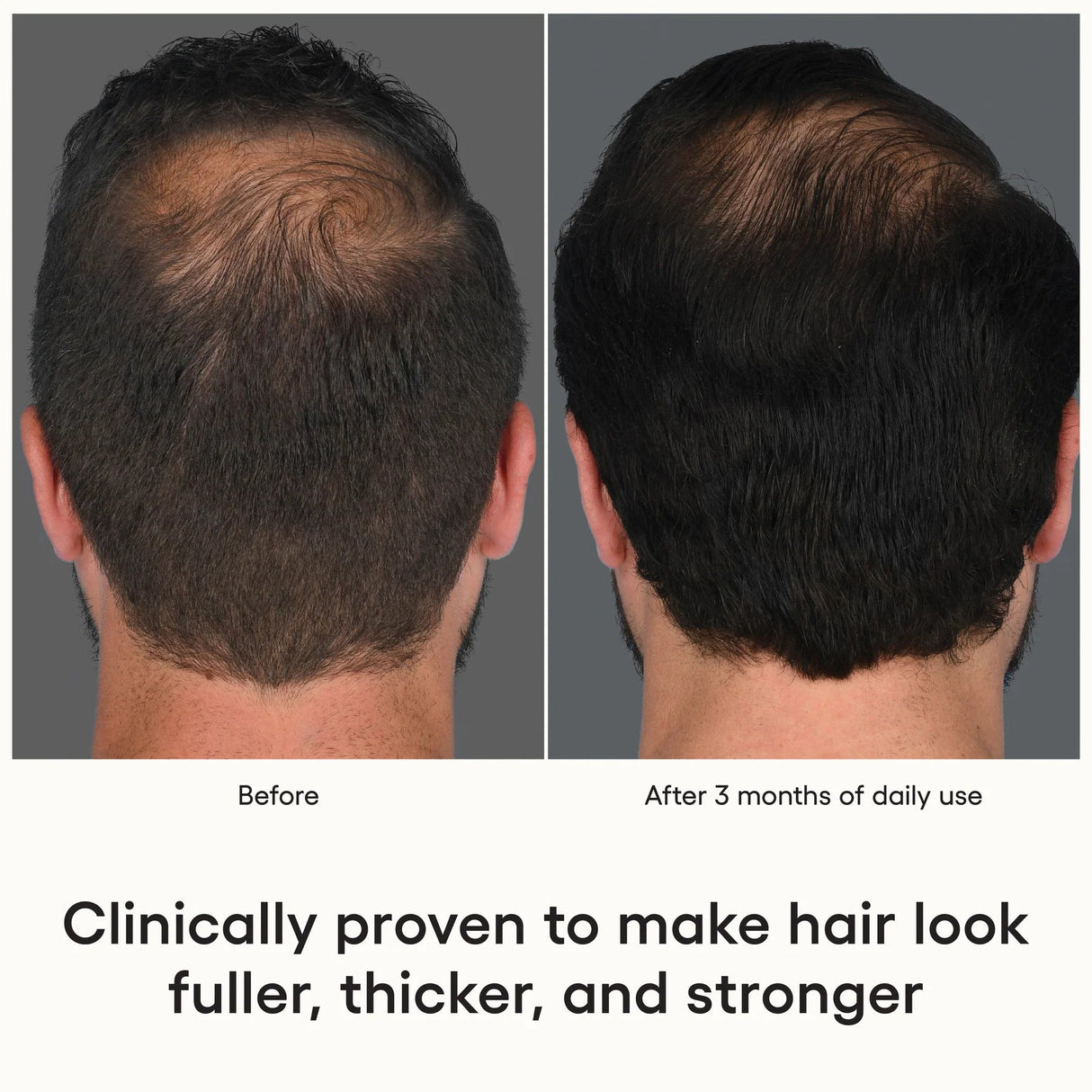 ( plated )™ HAIR Serum - Your Skincare Source - before and after 3 months on male