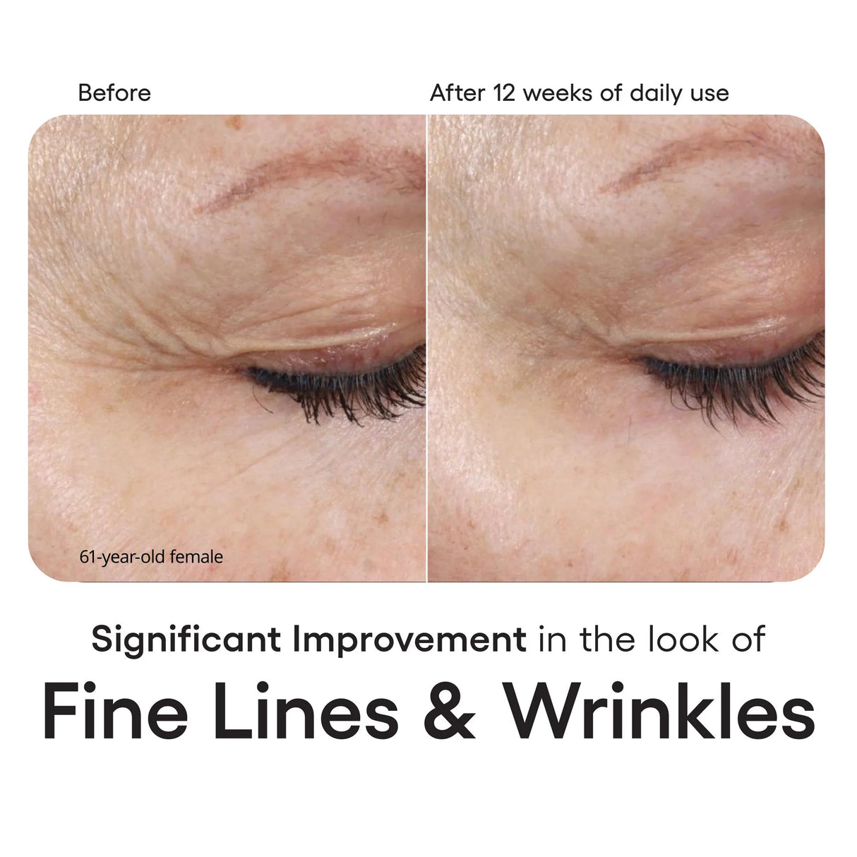 ( plated )™ INTENSE Serum Refill - Your Skincare Source