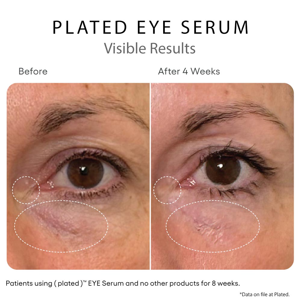 Plated Skin Science EYE Serum - Your Skincare Source