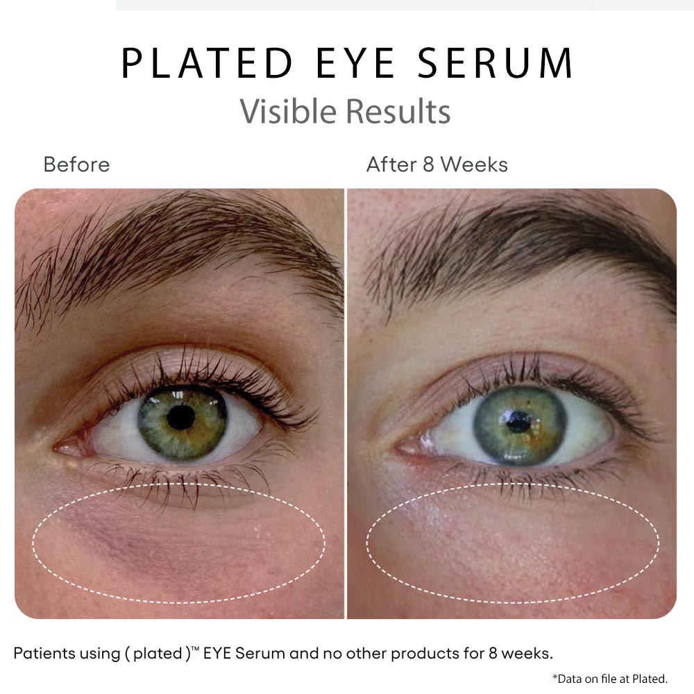 Plated Skin Science EYE Serum - Your Skincare Source