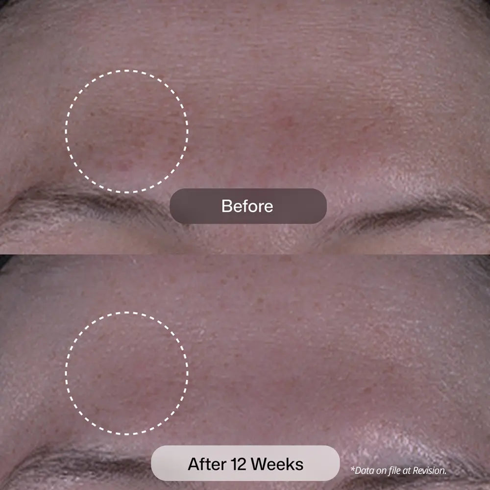 Revision Skincare Tone+ Correcting Pads before-and-after skin comparison showing the forehead area around the eyebrow, with a dotted circle highlighting skin texture and a 12-week improvement result.