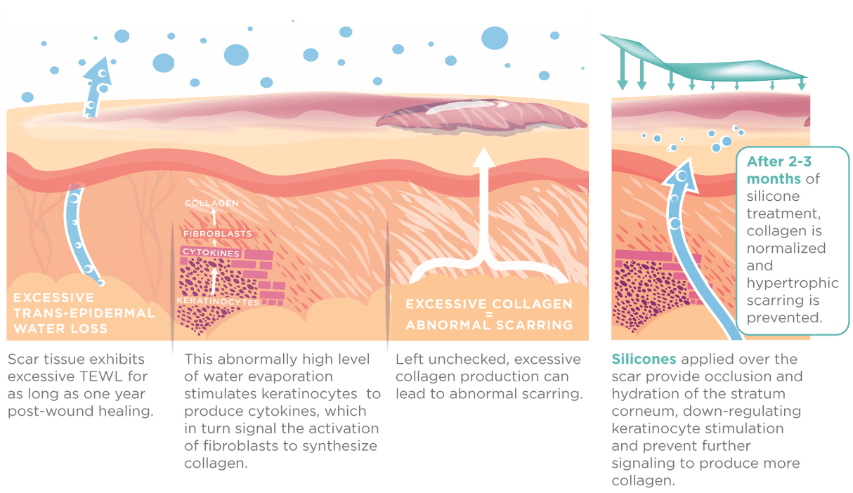 SilagenĀ® 100% Pure Silicone Gel + SPF 30 15g - Your Skincare Source