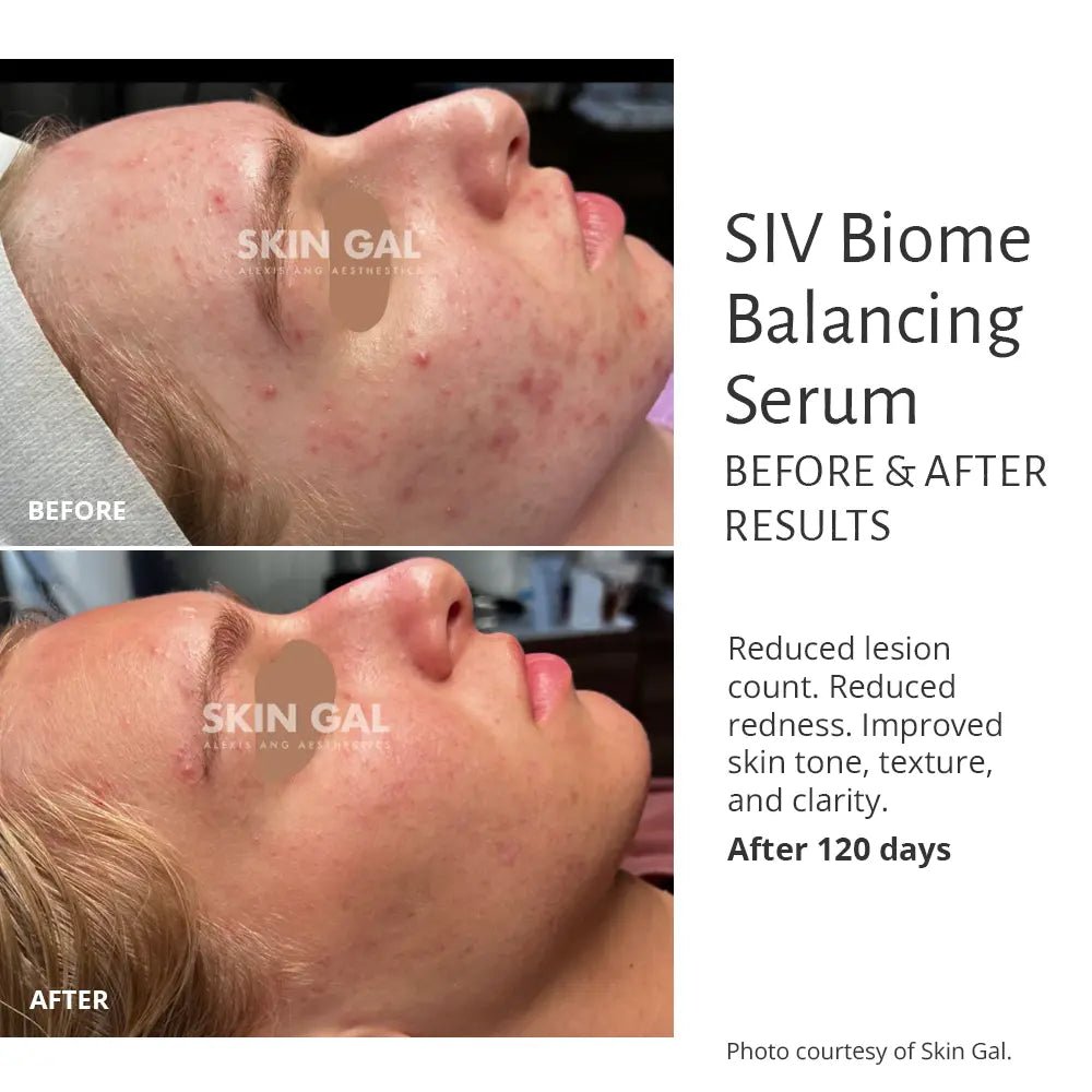 SIV Biome Balancing Serum