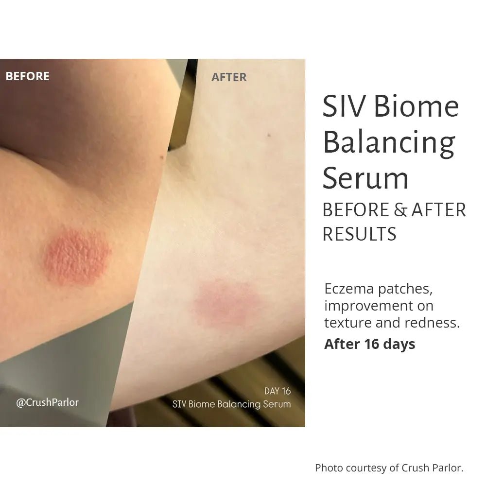 SIV Biome Balancing Serum