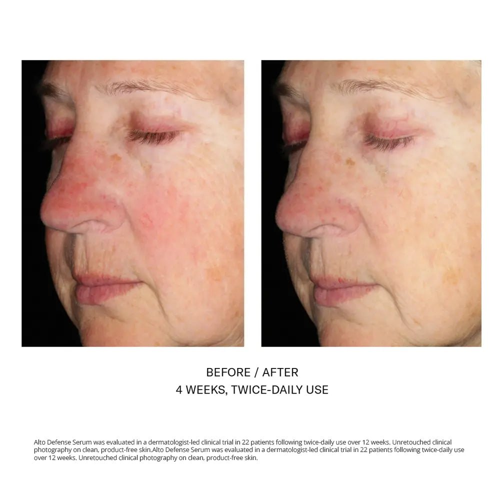 SkinBetter Alto Defense Serum