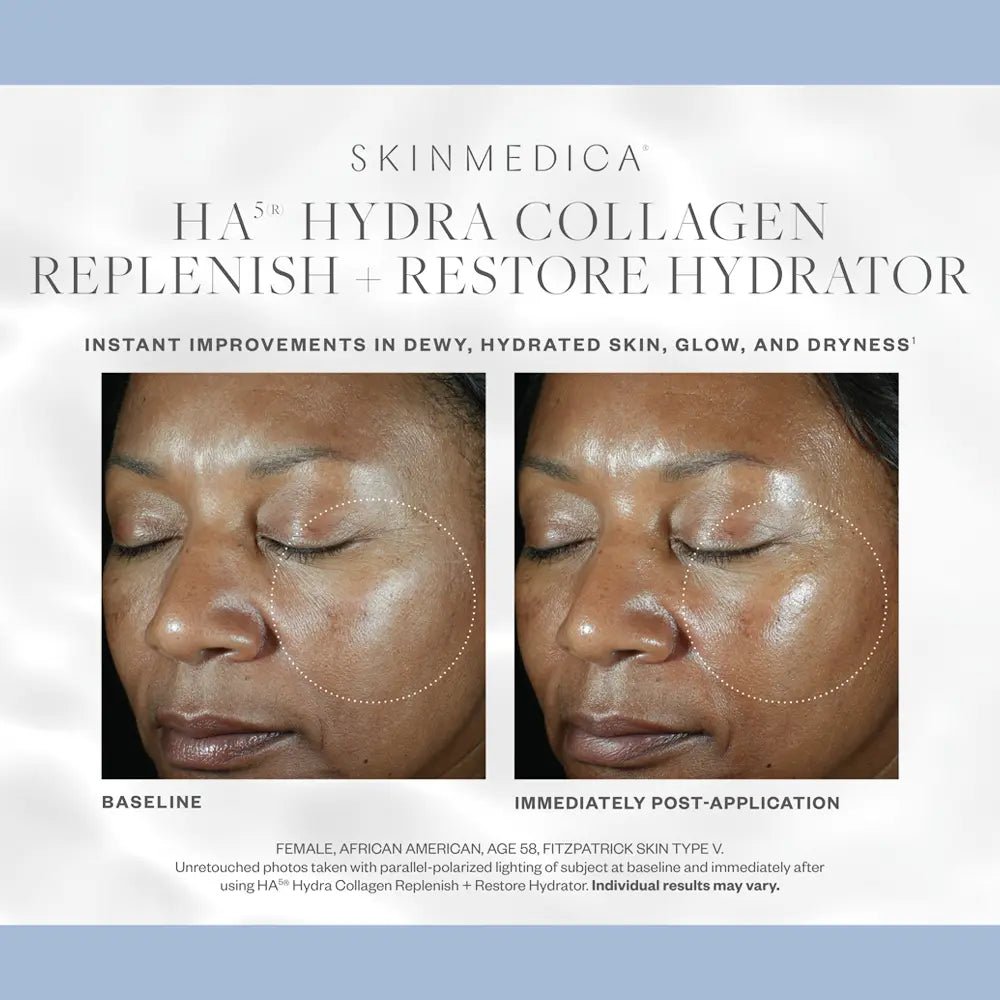 SkinMedica HA5 Hydra Collagen Replenish + Restore Hydrator