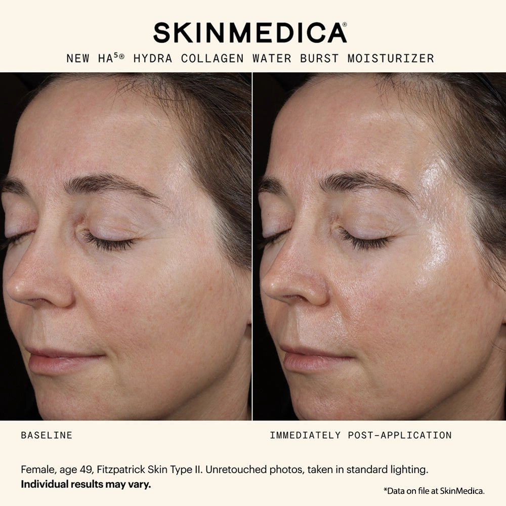 SkinMedica HA5 Hydra Collagen Water Burst Moisturizer