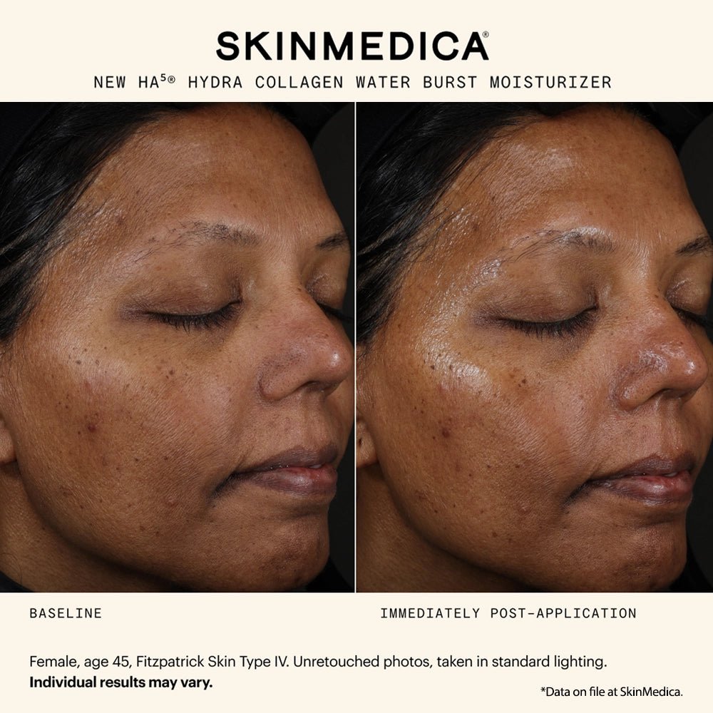 SkinMedica HA5 Hydra Collagen Water Burst Moisturizer