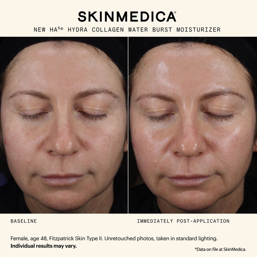 SkinMedica HA5 Hydra Collagen Water Burst Moisturizer