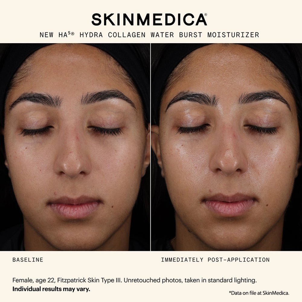 SkinMedica HA5 Hydra Collagen Water Burst Moisturizer