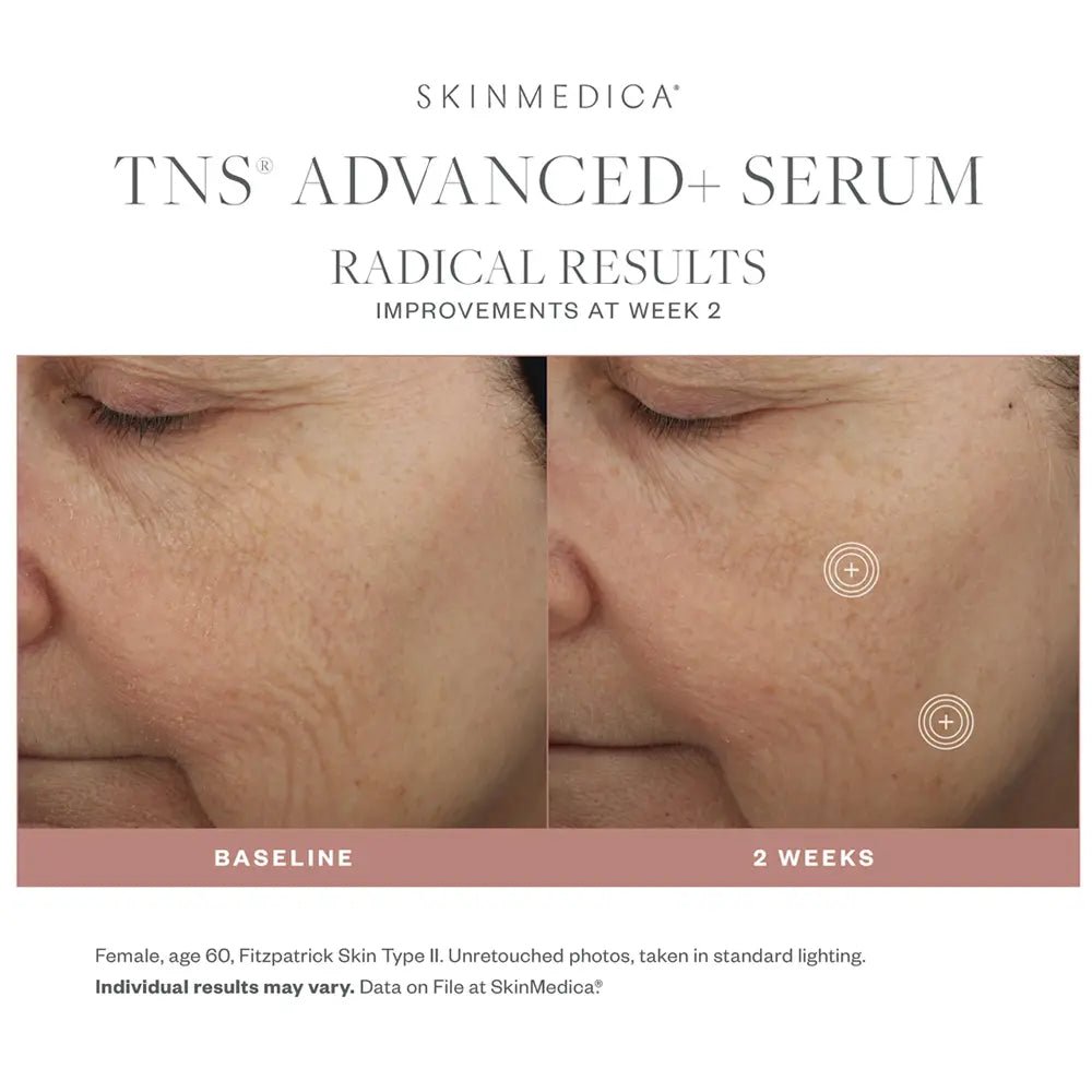 Before and after comparison of SkinMedica TNS Advanced+ Serum on a woman's face, showing improvements at Week 2.