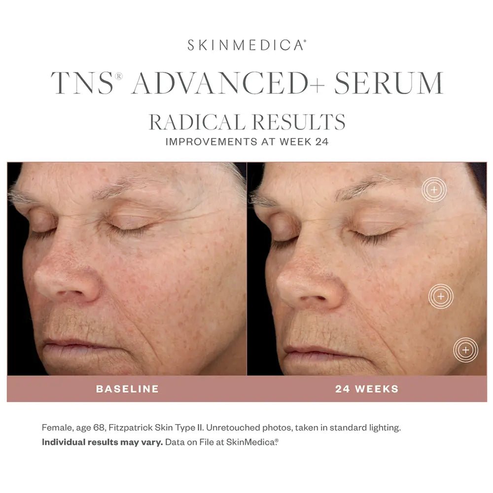 Before and after comparison of a woman's face with SkinMedica TNS Advanced+ Serum showing improvements at Week 24.