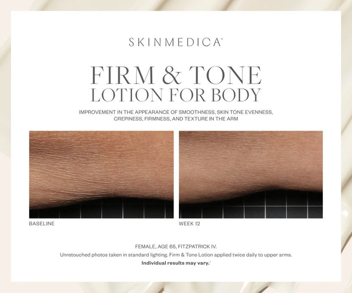 SkinMedica® Firm & Tone Body Lotion - Your Skincare Source
