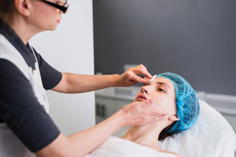 How To Fade Acne Scars