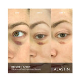 Alastin INhance Post-Injection Serum with TriHex Technology