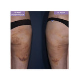 Alastin ReFORM & RePAIR Complex with TriHex Technology