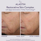 ALASTIN Restorative Skin Complex with New TriHex Technology
