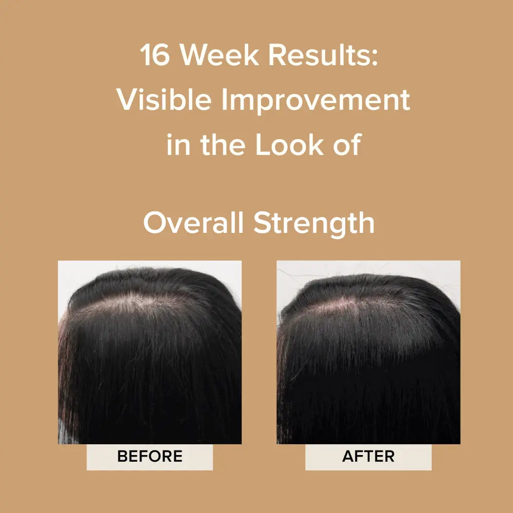 Before and after 16 weeks of Elevai Renew Exosome Scalp Serum showing stronger-looking hair along the part line