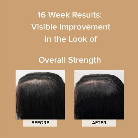 Before and after 16 weeks of Elevai Renew Exosome Scalp Serum showing stronger-looking hair along the part line