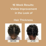 Before and after 16 weeks of Elevai Renew Exosome Scalp Serum showing visibly thicker-looking curly hair at the crown