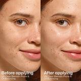Side-by-side close-up of a woman's face showing skin before and after applying EltaMD UV Clear Blemish-Prone and Oil Balancing SPF 50