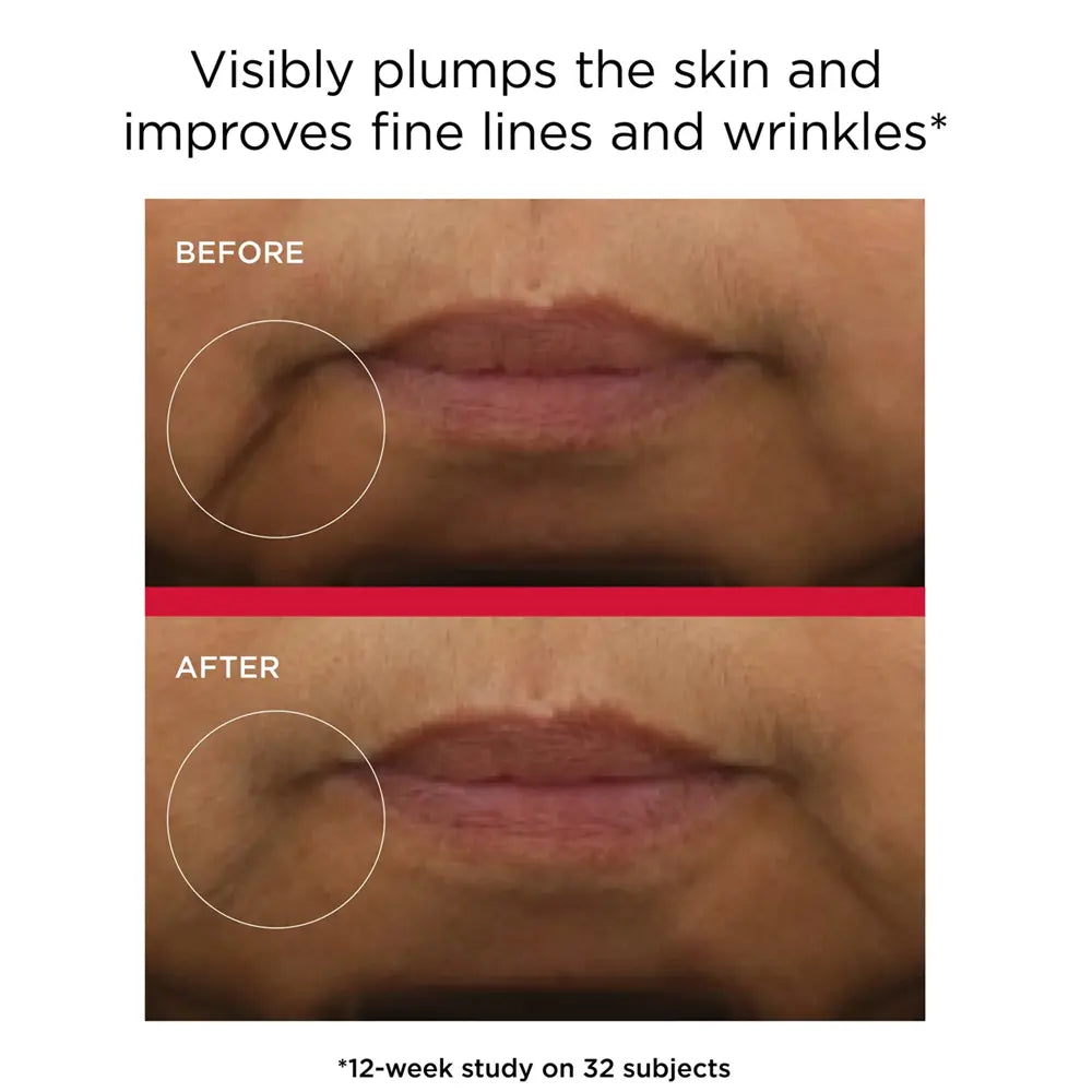 Before-and-after skin comparison showing a close-up of a person's mouth and cheek area, with text stating 'Visibly plumps the skin and improves fine lines and wrinkles' and '*12-week study on 32 subjects' using Elta MD Skincare UV Daily Hydration+ Broad Spectrum SPF 50