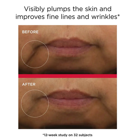 Before-and-after skin comparison showing a close-up of a person's mouth and cheek area, with text stating 'Visibly plumps the skin and improves fine lines and wrinkles' and '*12-week study on 32 subjects' using Elta MD Skincare UV Daily Hydration+ Broad Spectrum SPF 50
