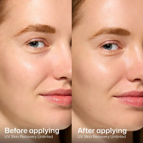 Before and after comparison of UV Skin Recovery Untinted on a person's face.