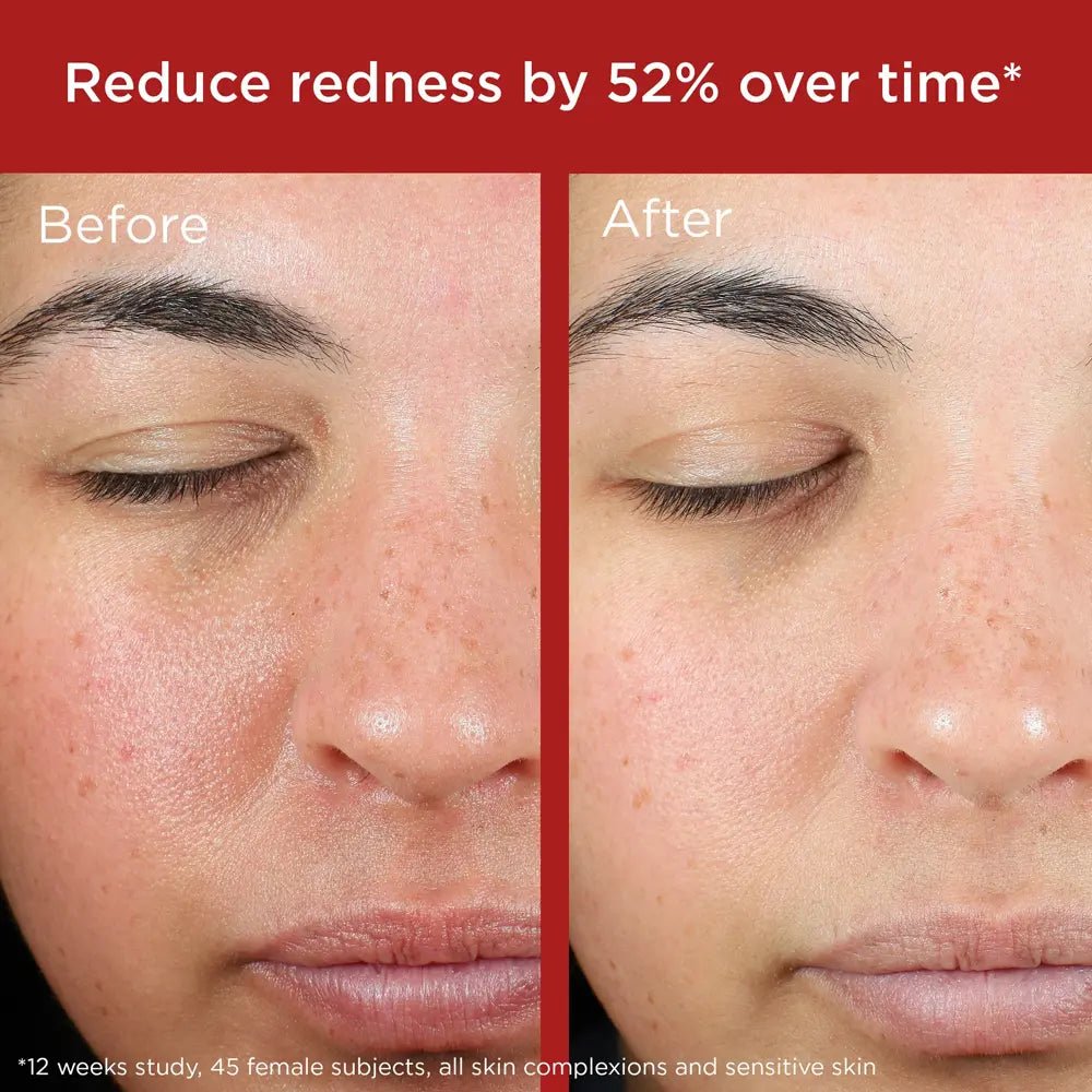 EltaMD UV UV Skin Recovery Red Color Correcting GREEN TINT Broad Spectrum SPF 50