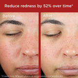 EltaMD UV UV Skin Recovery Red Color Correcting GREEN TINT Broad Spectrum SPF 50