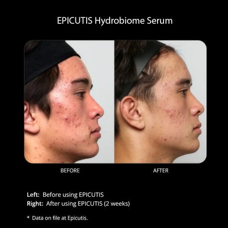 Epicutis Hydrobiome Serum