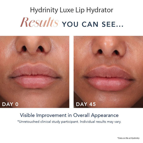 HYDRINITY Luxe Lip Hydrator - Your Skincare Source