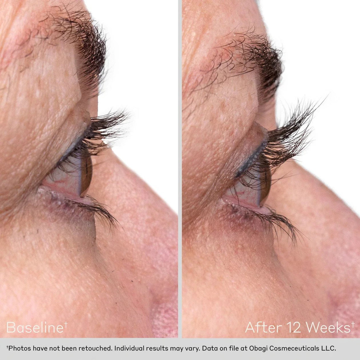 OBAGI Nu - Cil™ Eyelash Enhancing Serum - Your Skincare Source