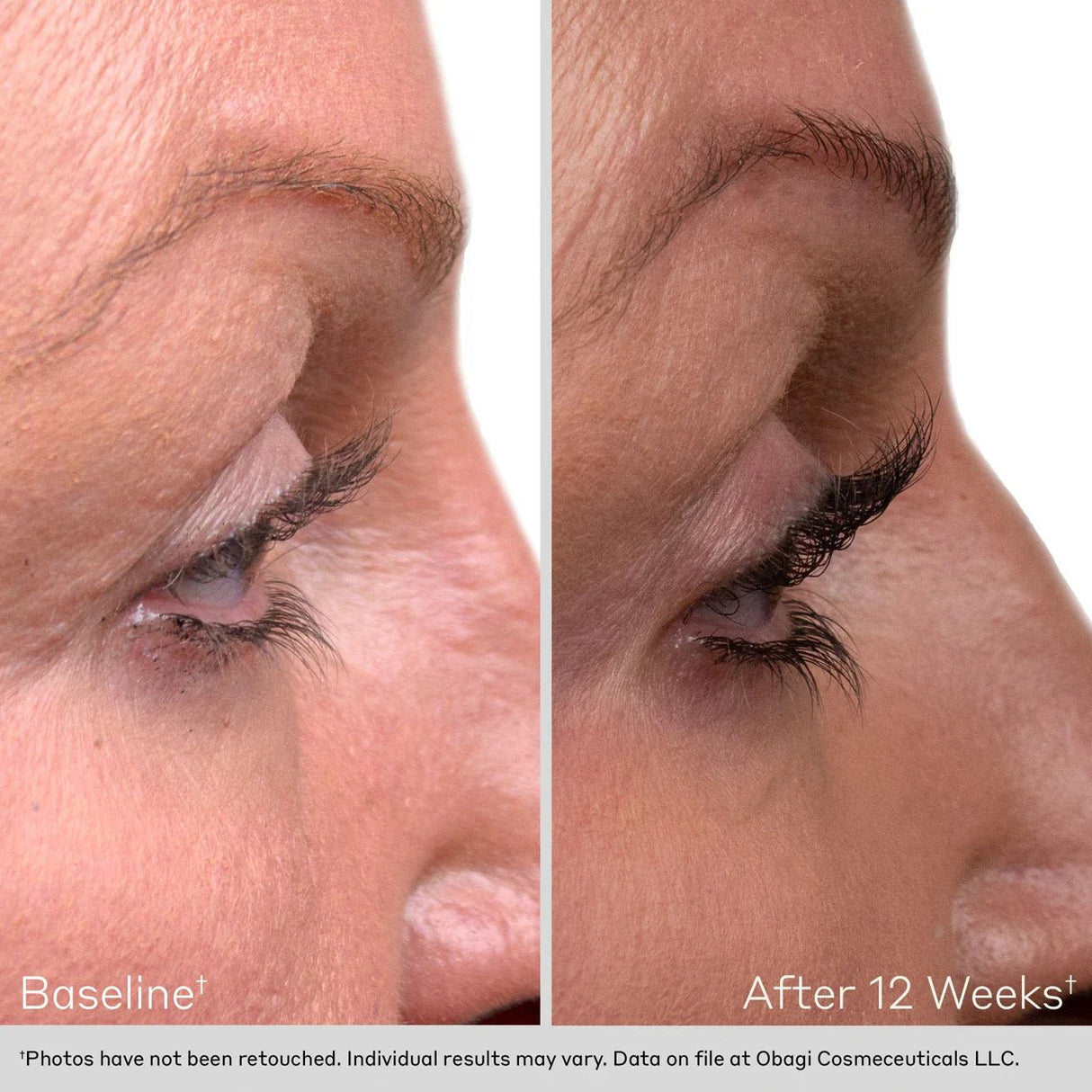 OBAGI Nu - Cil™ Eyelash Enhancing Serum - Your Skincare Source