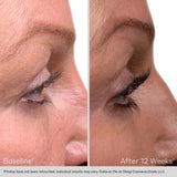 OBAGI Nu - Cil™ Eyelash Enhancing Serum - Your Skincare Source