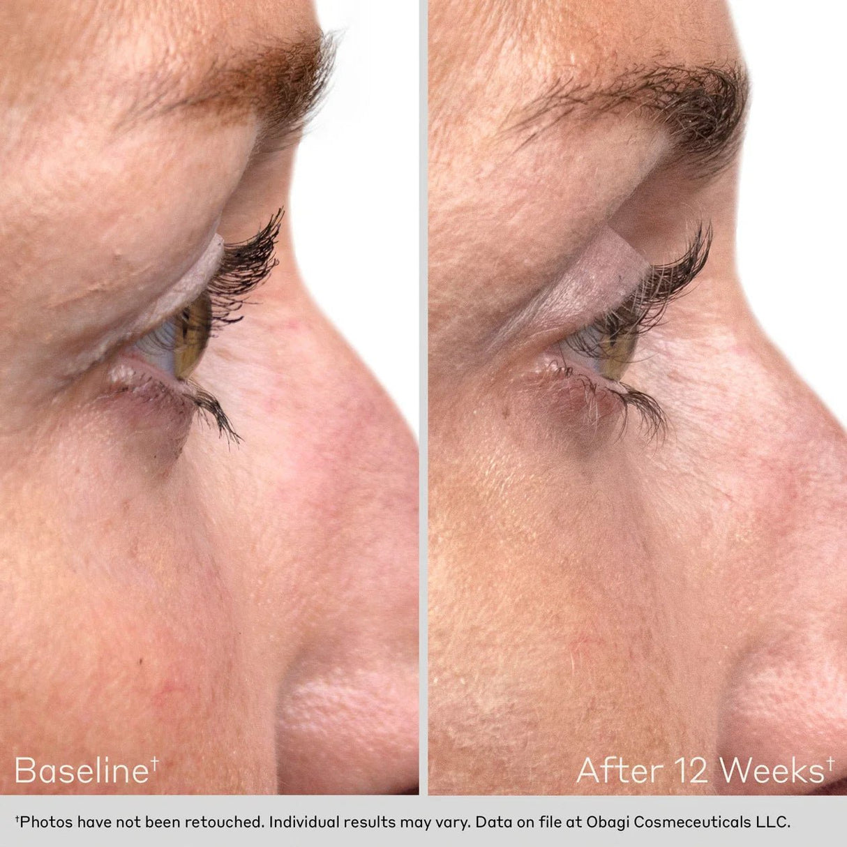 OBAGI Nu - Cil™ Eyelash Enhancing Serum - Your Skincare Source