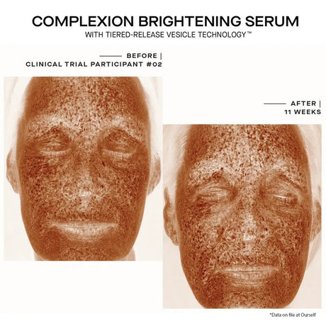 Ourself Complexion Brightening Serum