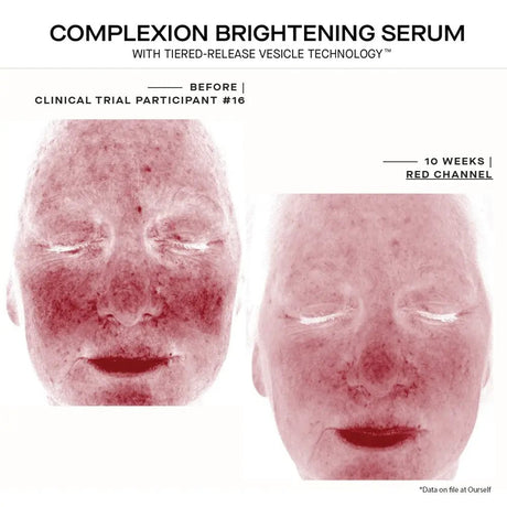 Ourself Complexion Brightening Serum