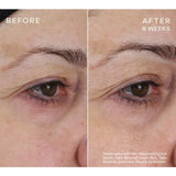 Ourself HA Replenishing Eye Serum